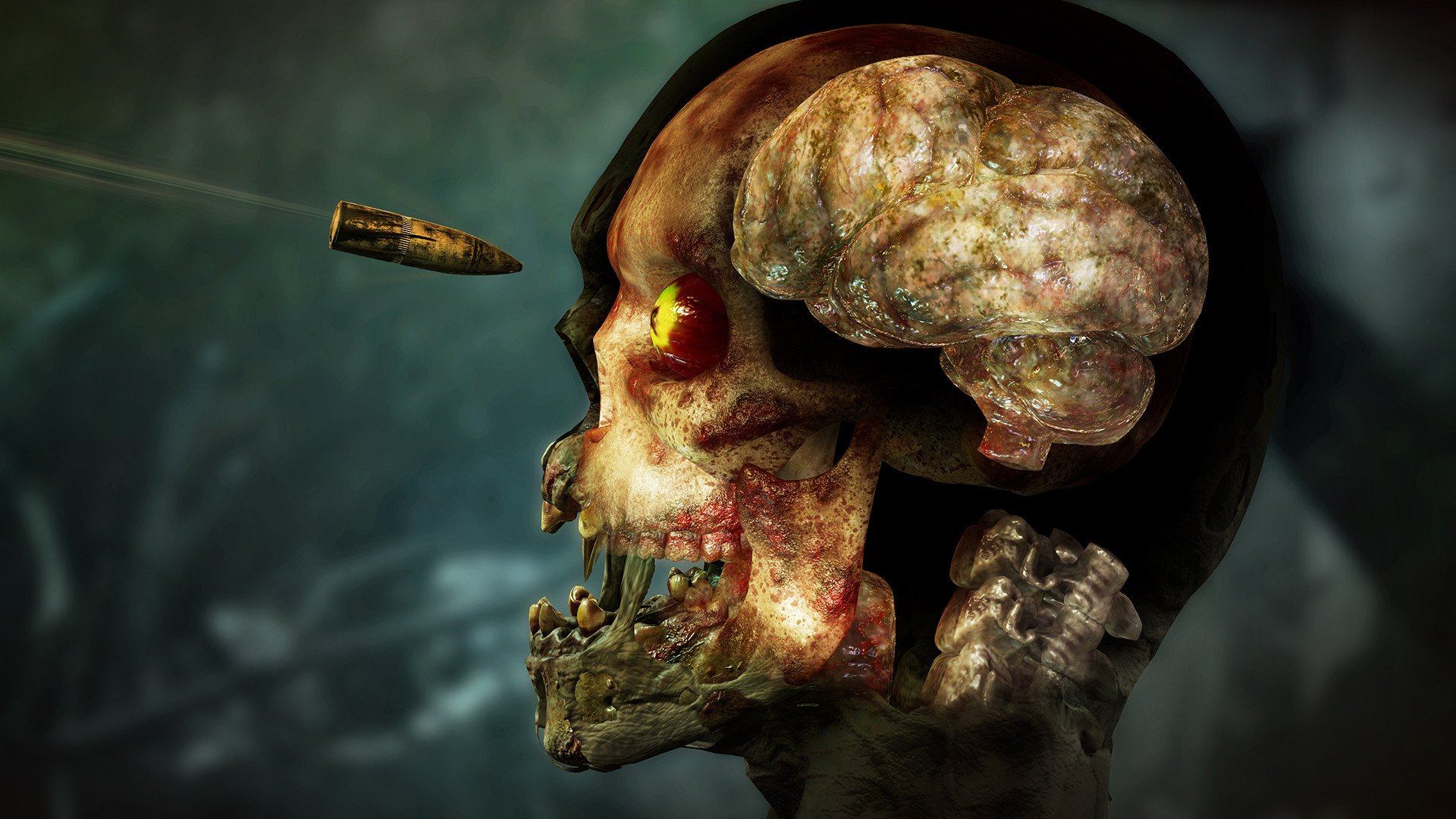 ESD Zombie Army 4 Dead War 