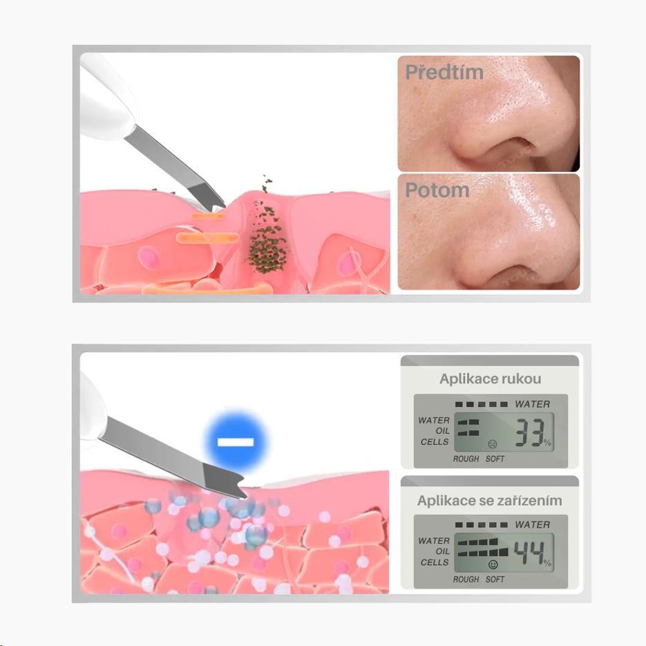 TOUCHBeauty 1887 Ultrazvuková špachtle na pleť3 