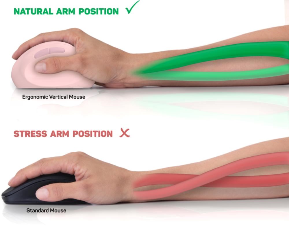 CONNECT IT FOR HEALTH LADIES PINK Bezdrátová vertikální myš,  ergonomická,  růžová7 