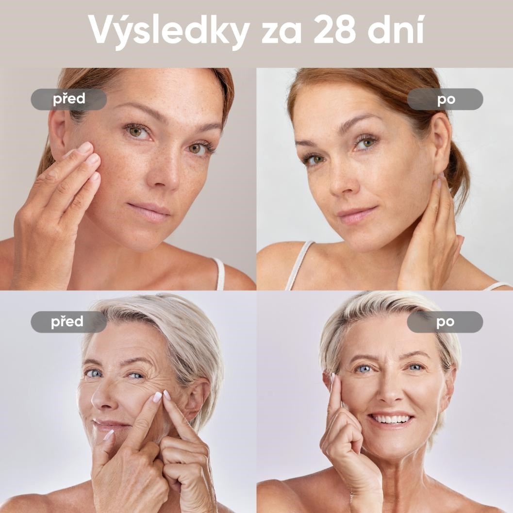 BAZAR - JOVS 4D v2 laserová světelná terapeutická maska - Poškozený obal (Komplet)10 