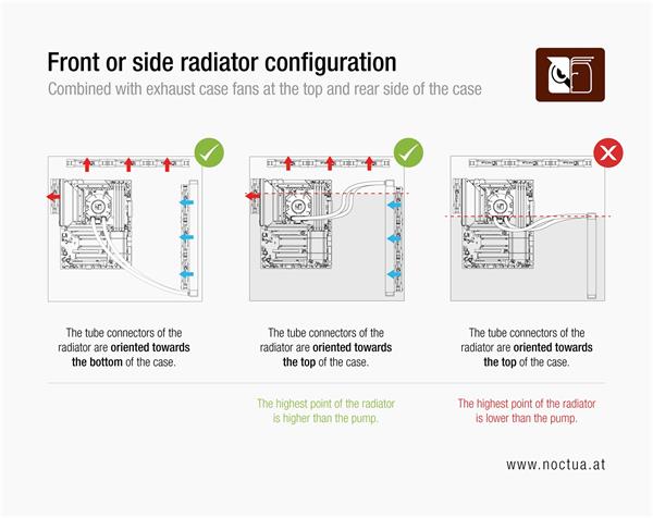 Noctua NL-LC1-36 AIO chladič CPU 360mm 